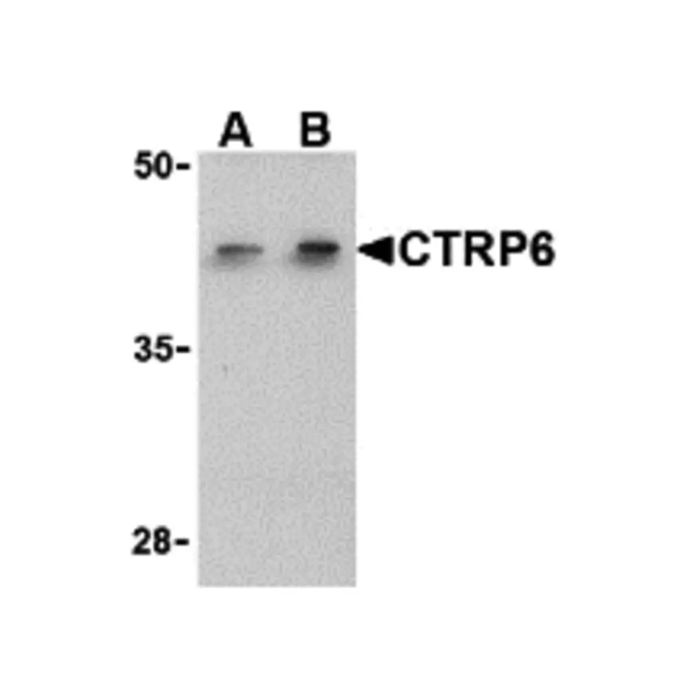 ProSci 3575_S CTRP6 Antibody, ProSci, 0.02 mg/Unit Primary Image