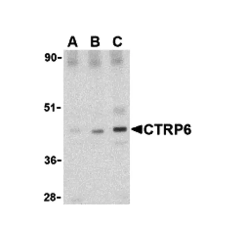 ProSci 3577 CTRP6 Antibody, ProSci, 0.1 mg/Unit Primary Image