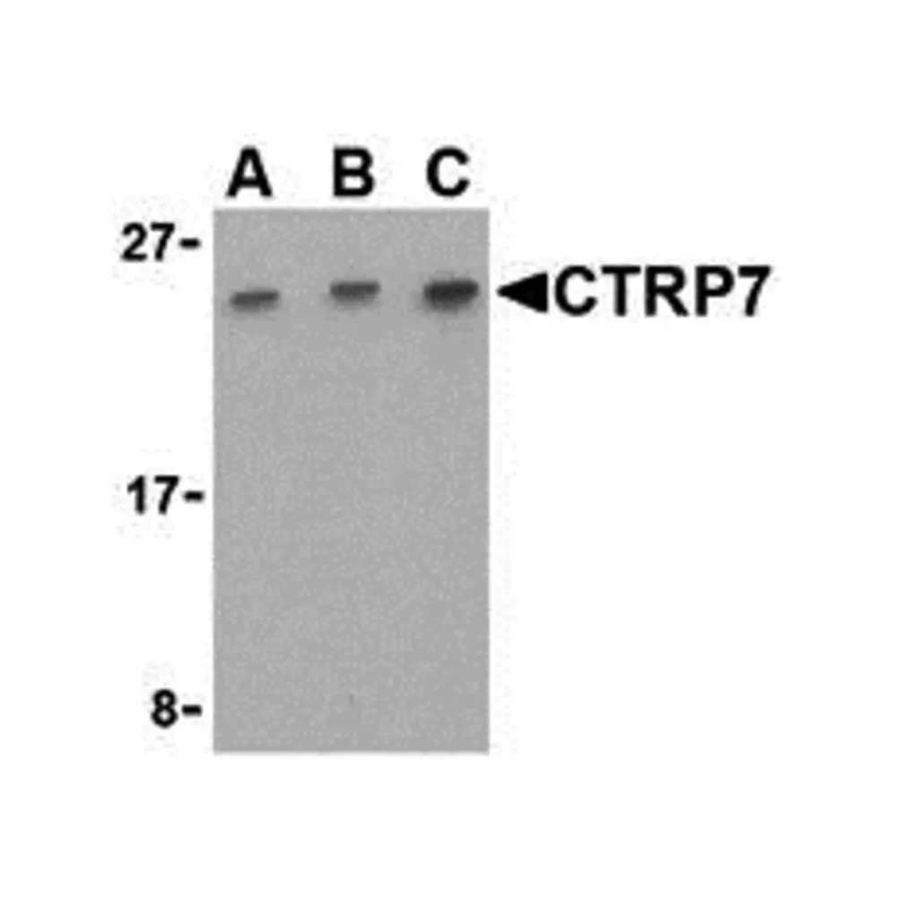 ProSci 3579_S CTRP7 Antibody, ProSci, 0.02 mg/Unit Primary Image