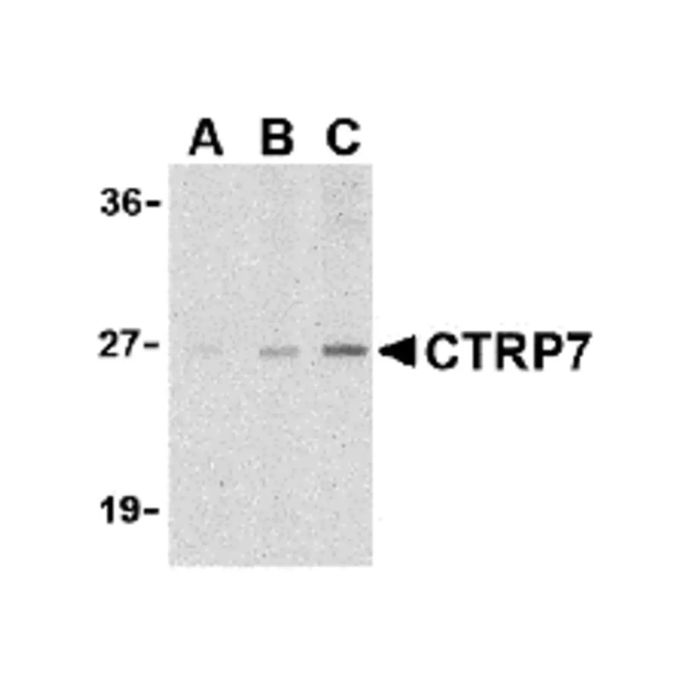 ProSci 3581_S CTRP7 Antibody, ProSci, 0.02 mg/Unit Primary Image