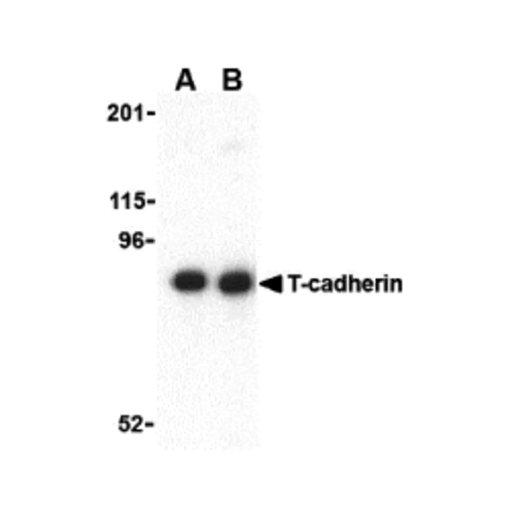 ProSci 3583 T-cadherin Antibody, ProSci, 0.1 mg/Unit Primary Image
