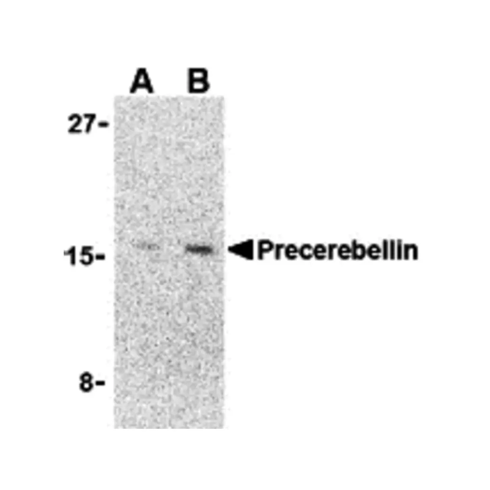 ProSci 3587 Precerebellin Antibody, ProSci, 0.1 mg/Unit Primary Image