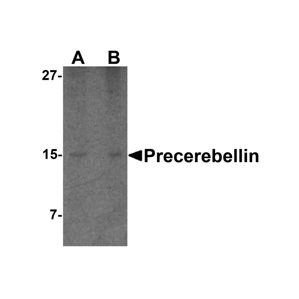 ProSci 3589 Precerebellin Antibody, ProSci, 0.1 mg/Unit Primary Image