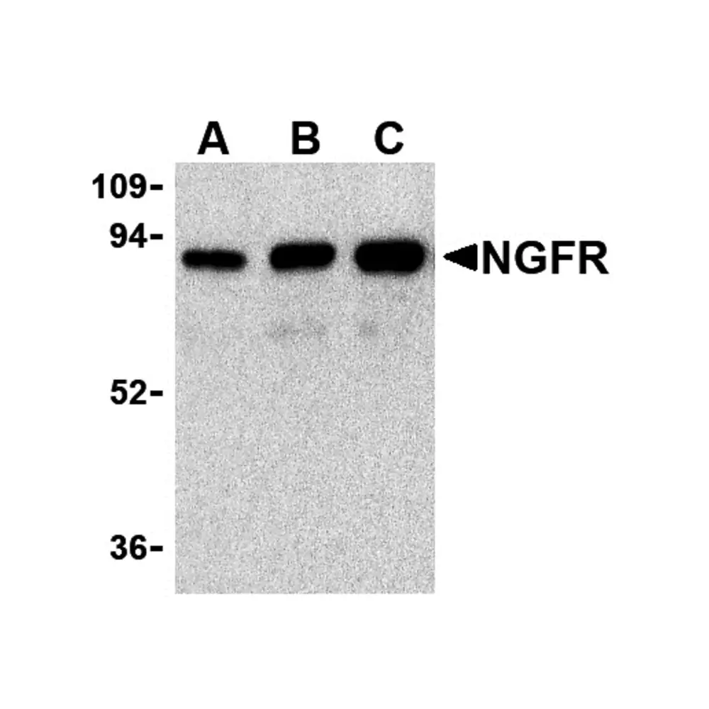 ProSci 3593_S NGFR Antibody, ProSci, 0.02 mg/Unit Primary Image