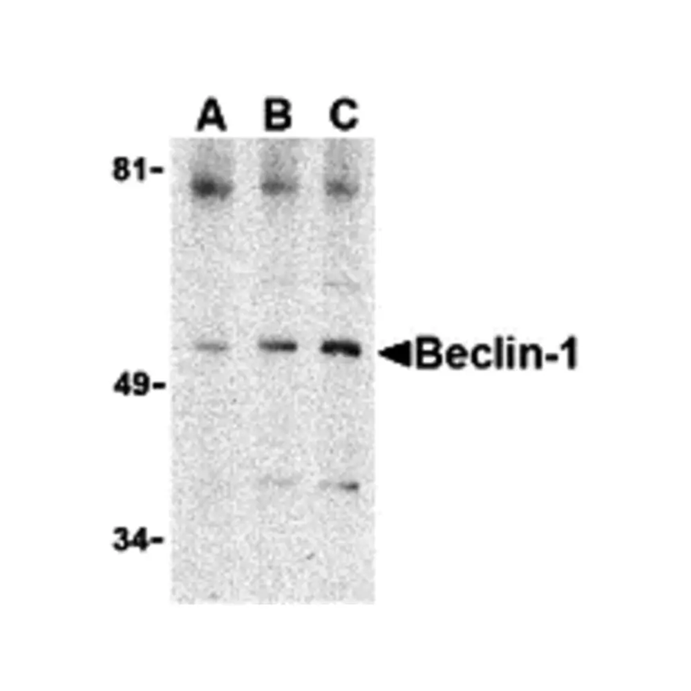 ProSci 3611 Beclin-1 Antibody, ProSci, 0.1 mg/Unit Primary Image