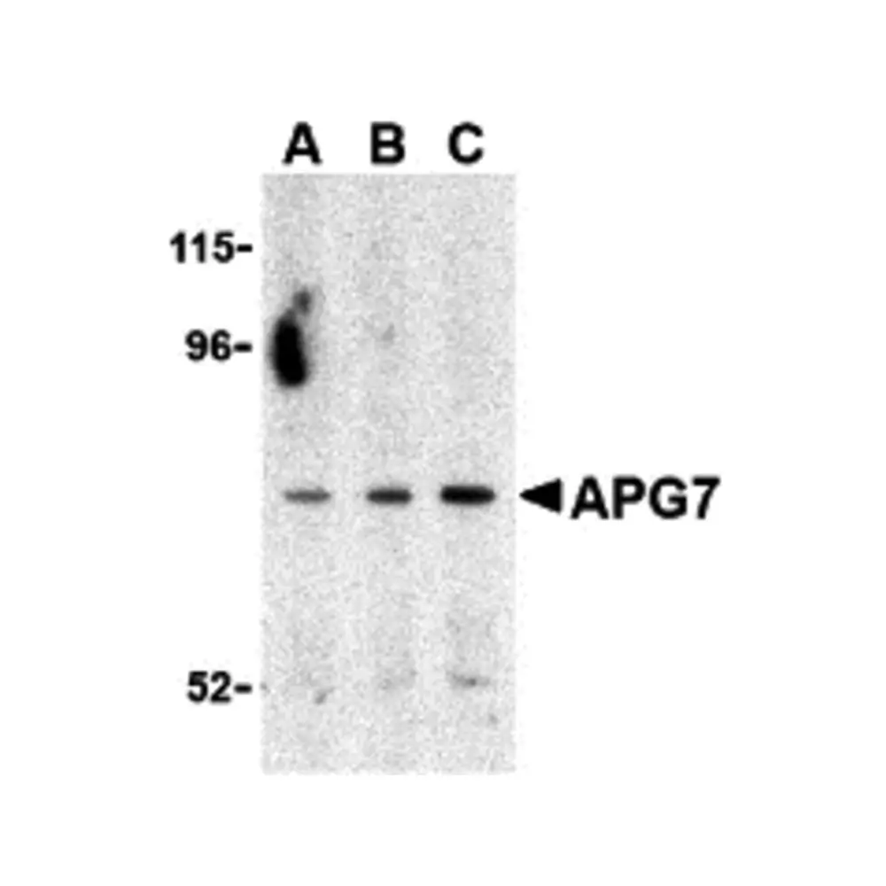 ProSci 3615_S APG7 Antibody, ProSci, 0.02 mg/Unit Primary Image