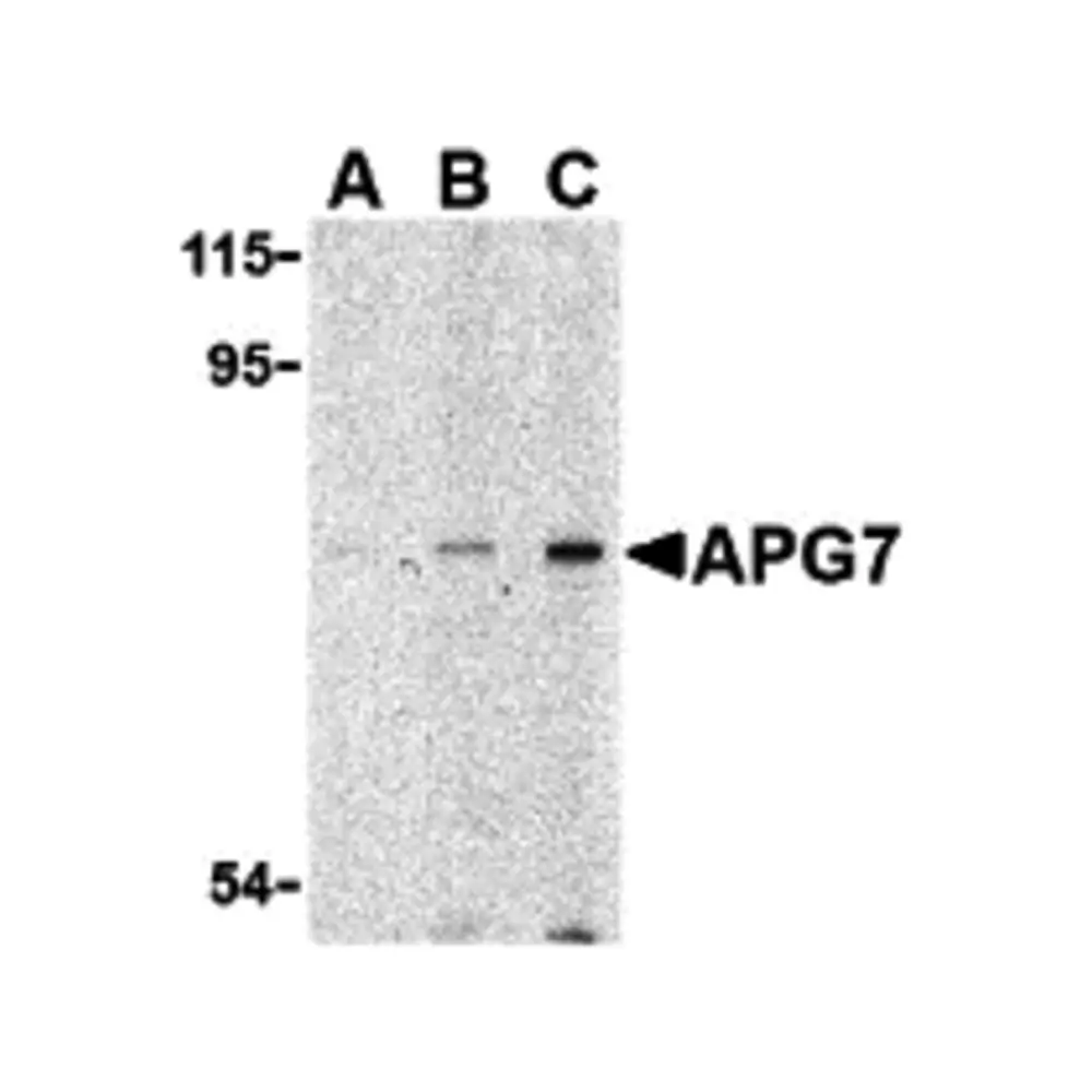 ProSci 3617_S APG7 Antibody, ProSci, 0.02 mg/Unit Primary Image
