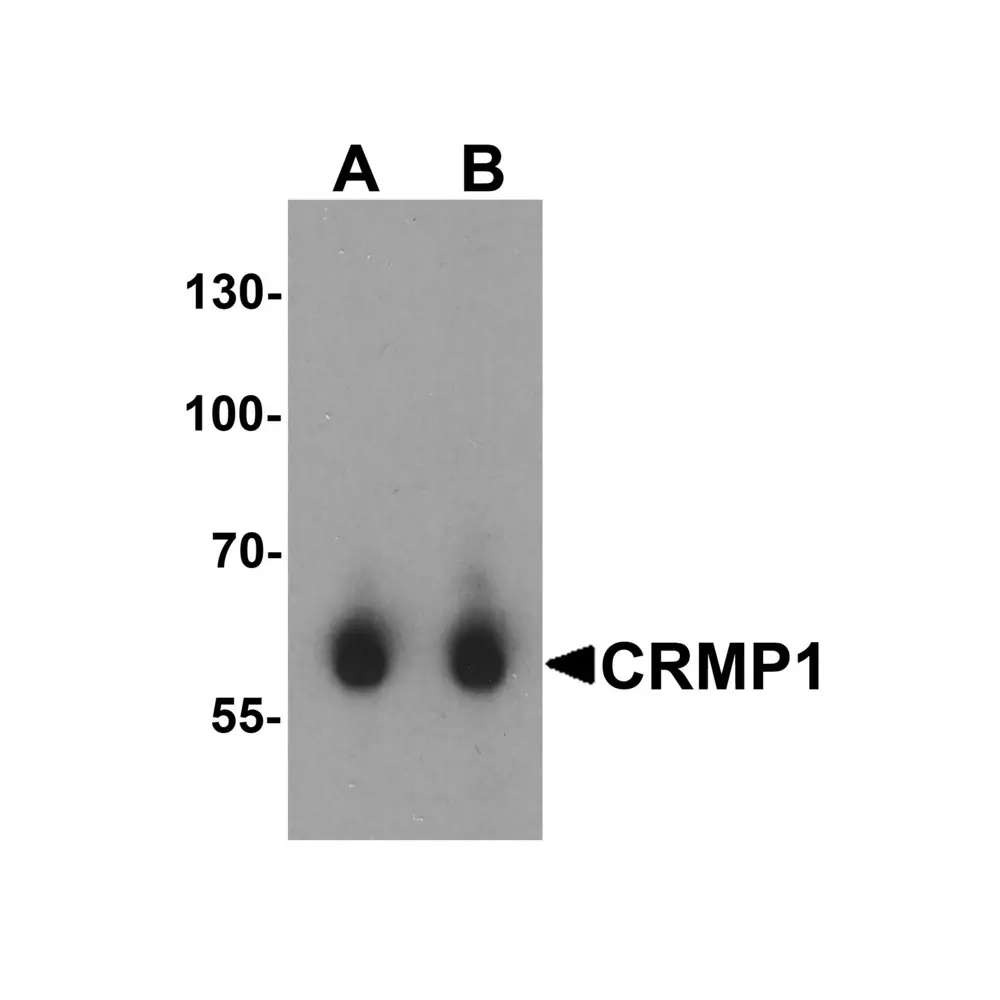 ProSci 3623 CRMP1 Antibody, ProSci, 0.1 mg/Unit Primary Image