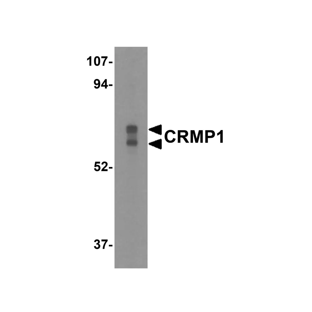 ProSci 3625 CRMP1 Antibody, ProSci, 0.1 mg/Unit Primary Image