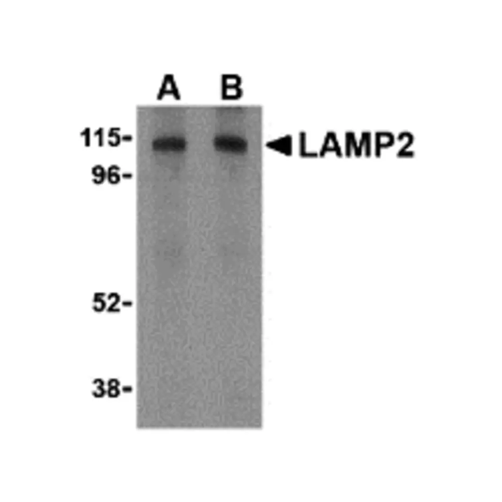 ProSci 3627 LAMP-2 Antibody, ProSci, 0.1 mg/Unit Primary Image