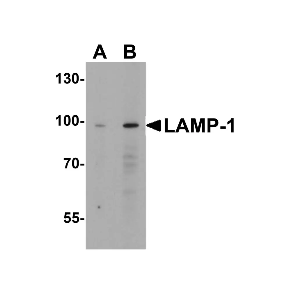 ProSci 3629_S LAMP-1 Antibody, ProSci, 0.02 mg/Unit Primary Image