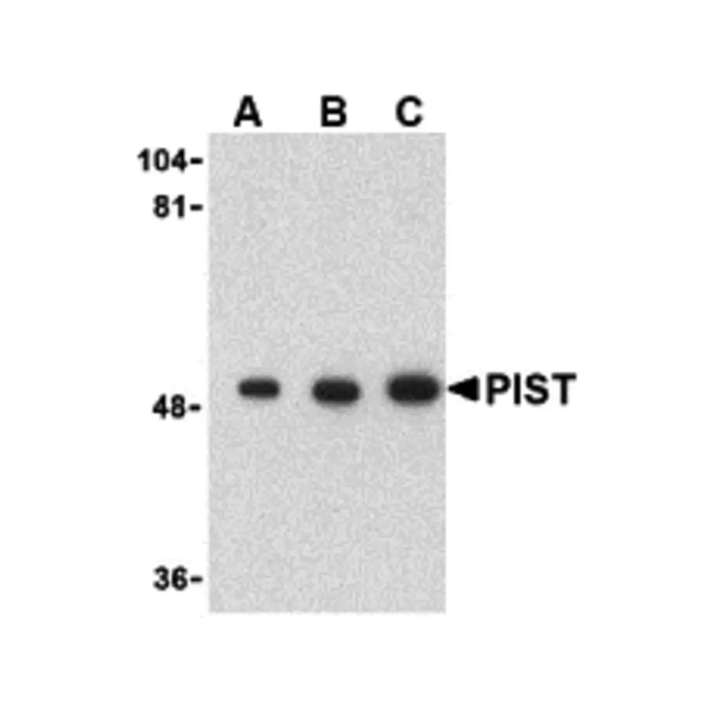 ProSci 3631_S PIST Antibody, ProSci, 0.02 mg/Unit Primary Image