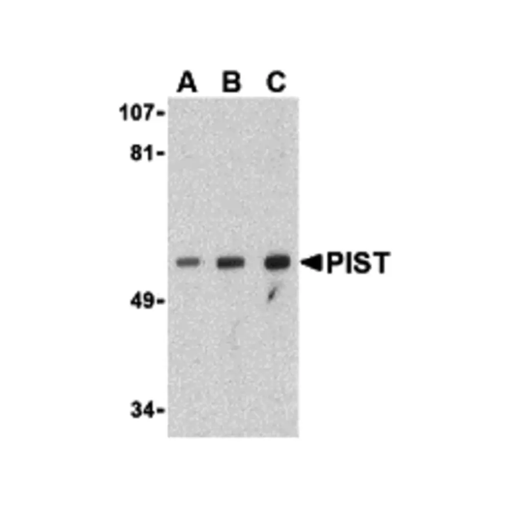 ProSci 3633_S PIST Antibody, ProSci, 0.02 mg/Unit Primary Image