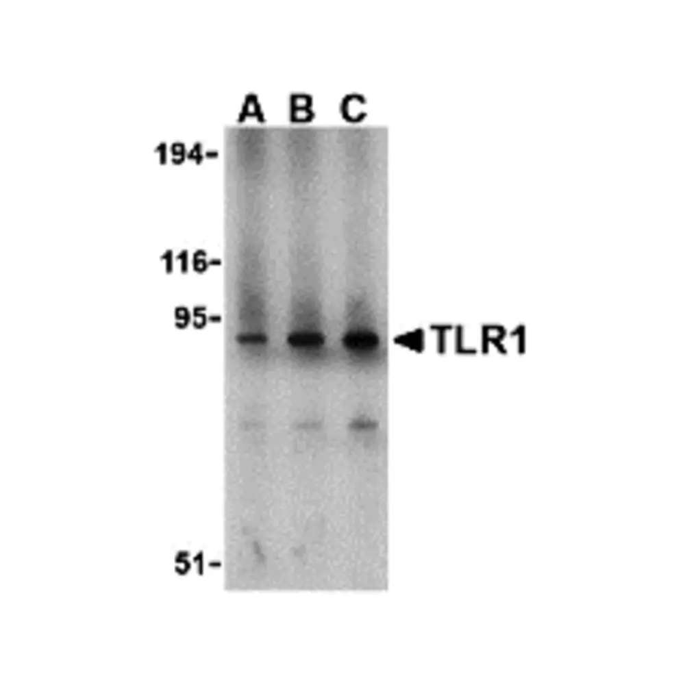 ProSci 3639_S TLR1 Antibody, ProSci, 0.02 mg/Unit Primary Image