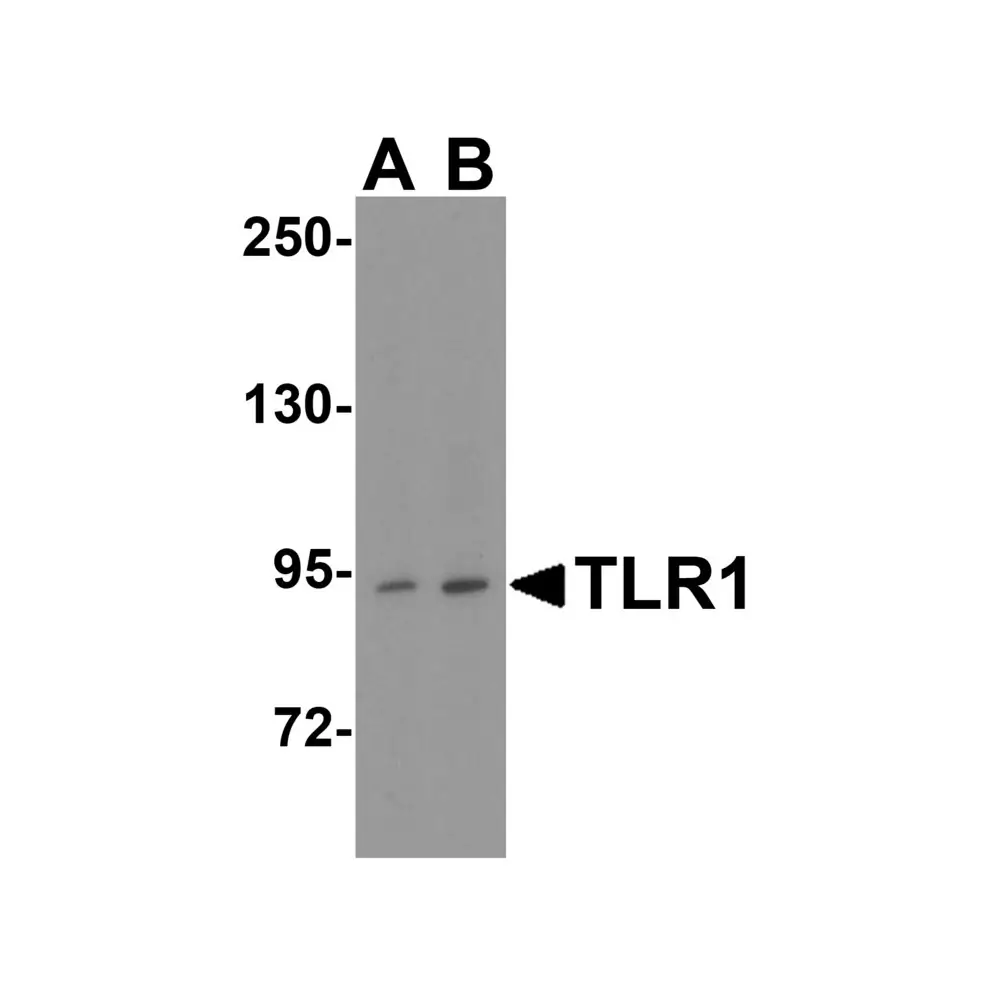 ProSci 3641 TLR1 Antibody, ProSci, 0.1 mg/Unit Primary Image
