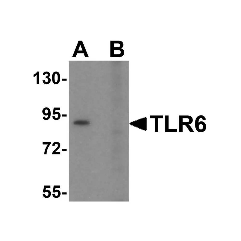 ProSci 3651 TLR6 Antibody, ProSci, 0.1 mg/Unit Primary Image