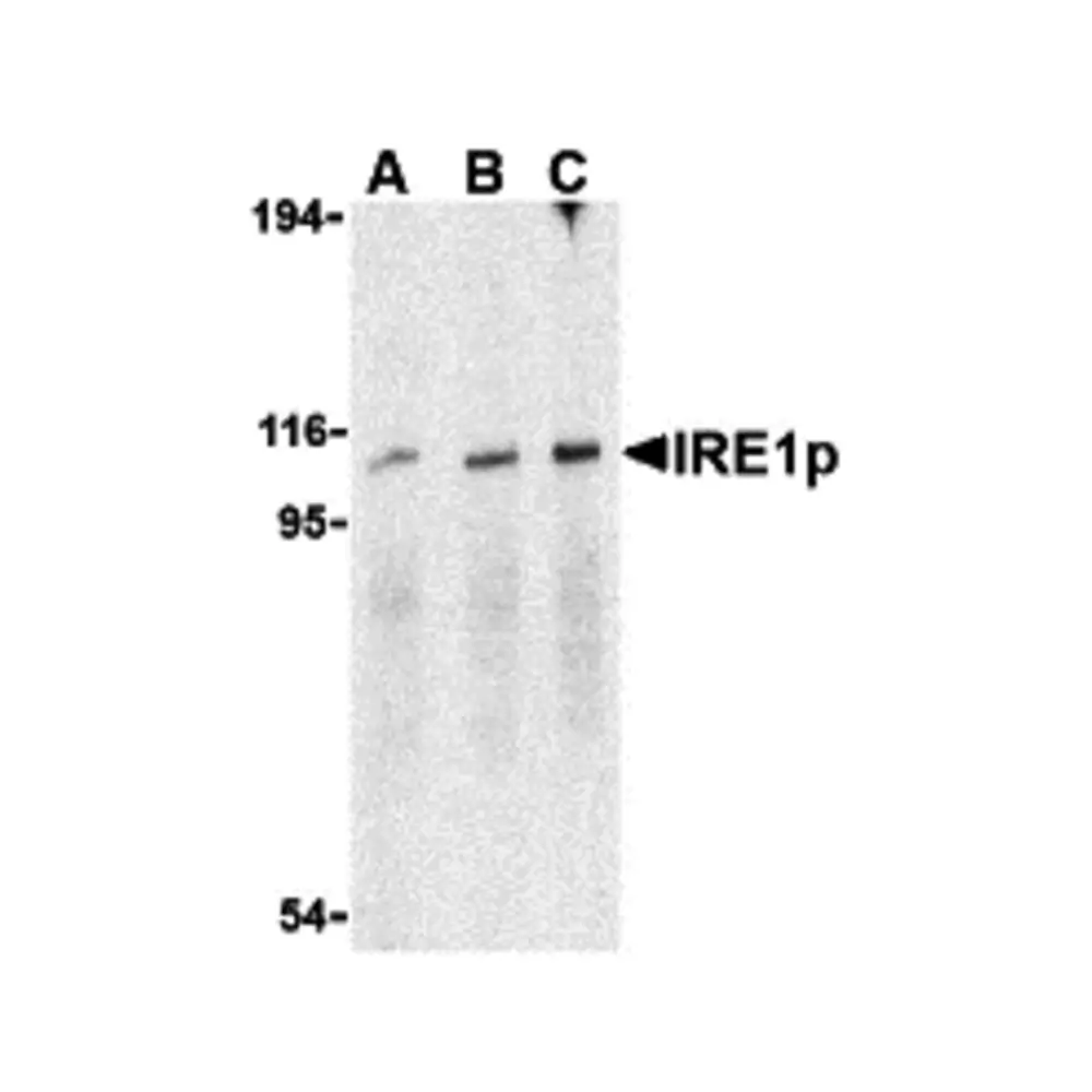 ProSci 3655 IRE1p Antibody, ProSci, 0.1 mg/Unit Primary Image