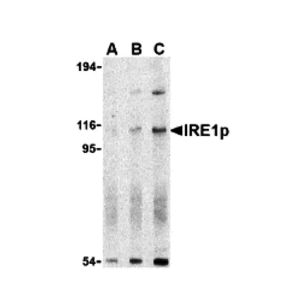 ProSci 3657 IRE1p Antibody, ProSci, 0.1 mg/Unit Primary Image