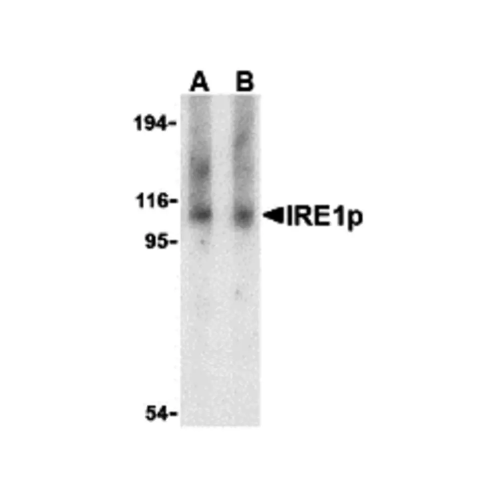 ProSci 3659 IRE1p Antibody, ProSci, 0.1 mg/Unit Primary Image