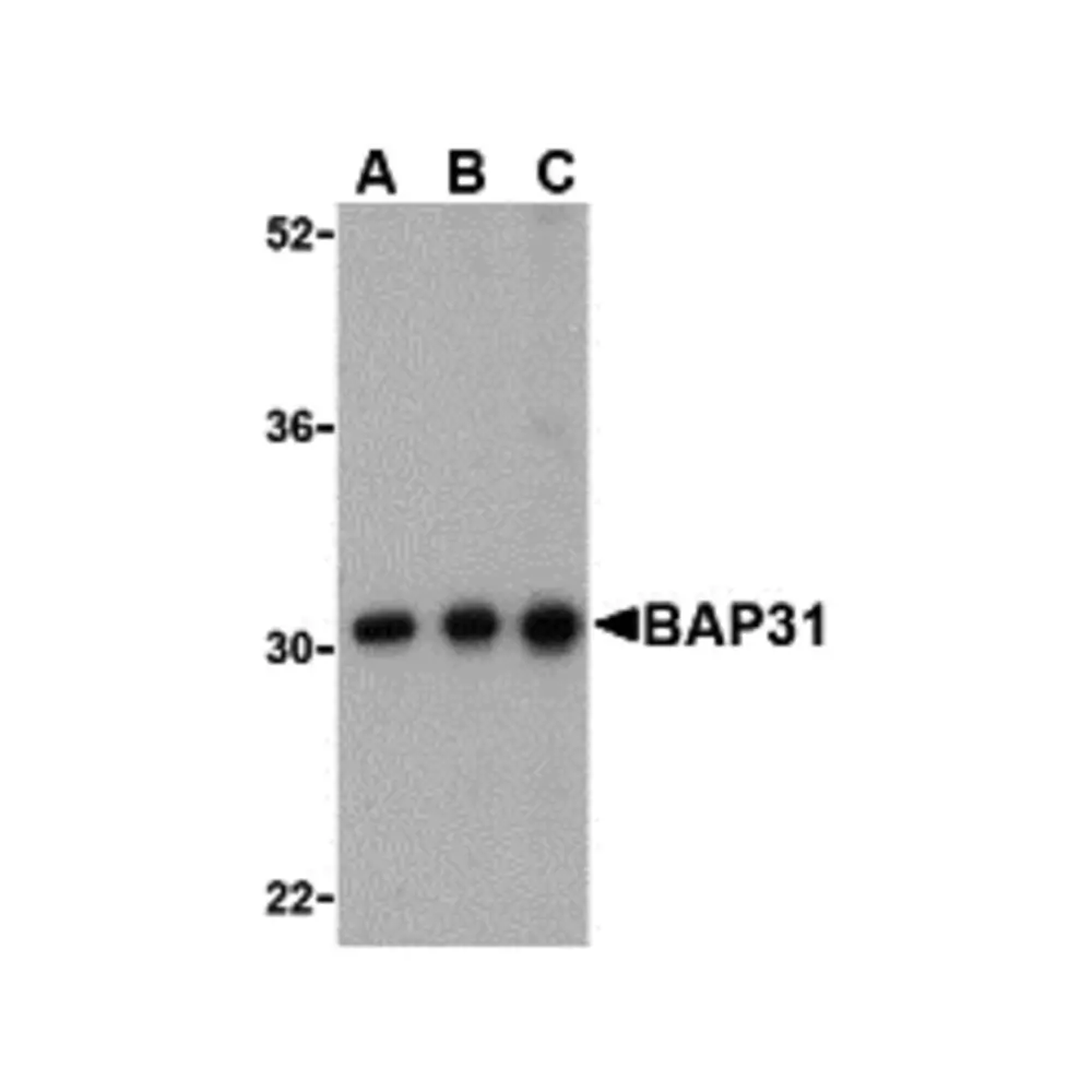ProSci 3665 BAP31 Antibody, ProSci, 0.1 mg/Unit Primary Image