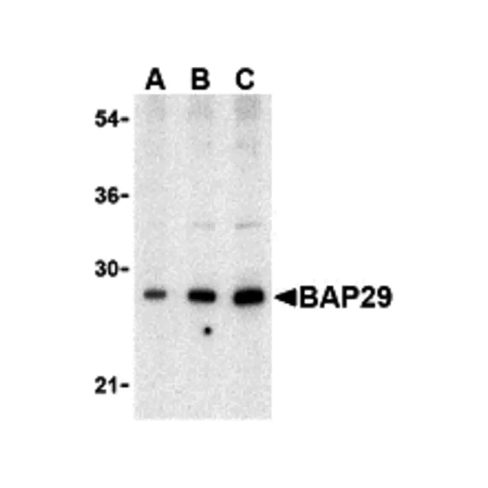 ProSci 3667 BAP29 Antibody, ProSci, 0.1 mg/Unit Primary Image
