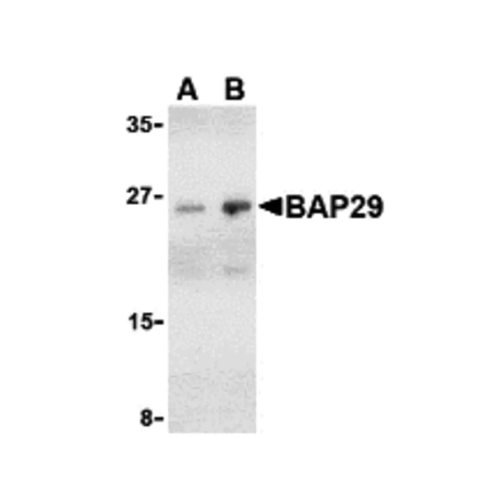 ProSci 3669 BAP29 Antibody, ProSci, 0.1 mg/Unit Primary Image