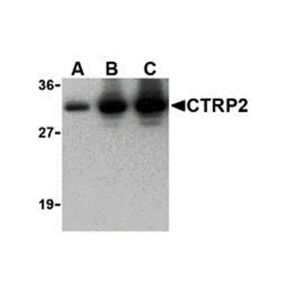 ProSci 3671 CTRP2 Antibody, ProSci, 0.1 mg/Unit Primary Image