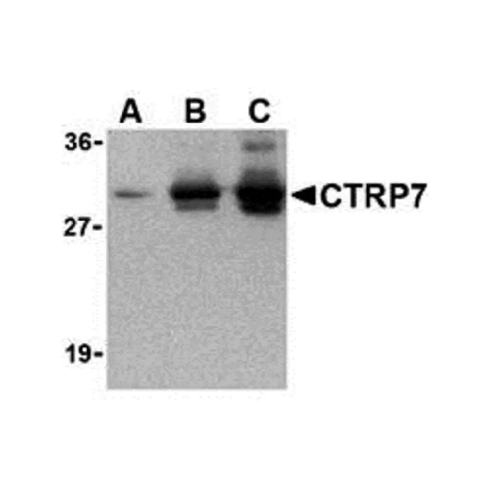 ProSci 3673_S CTRP7 Antibody, ProSci, 0.02 mg/Unit Primary Image