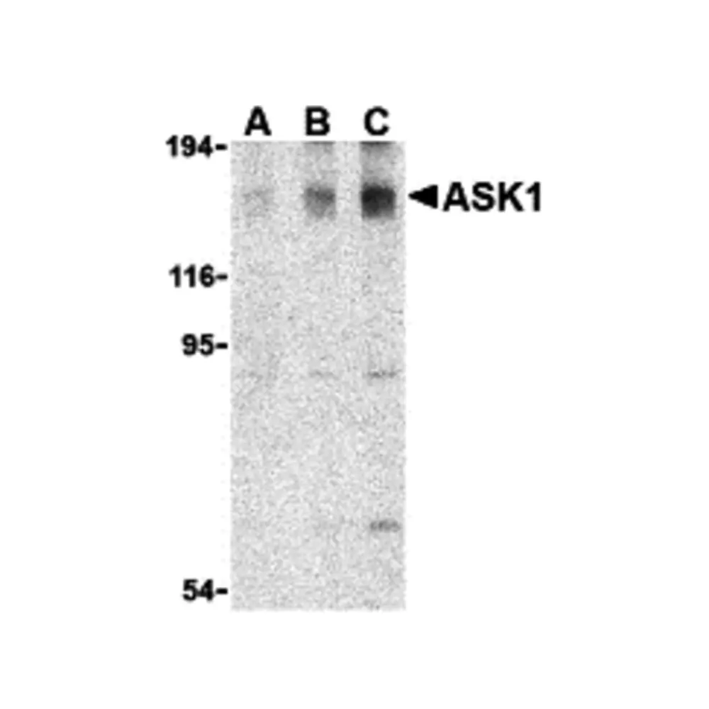 ProSci 3677_S ASK1 Antibody, ProSci, 0.02 mg/Unit Primary Image