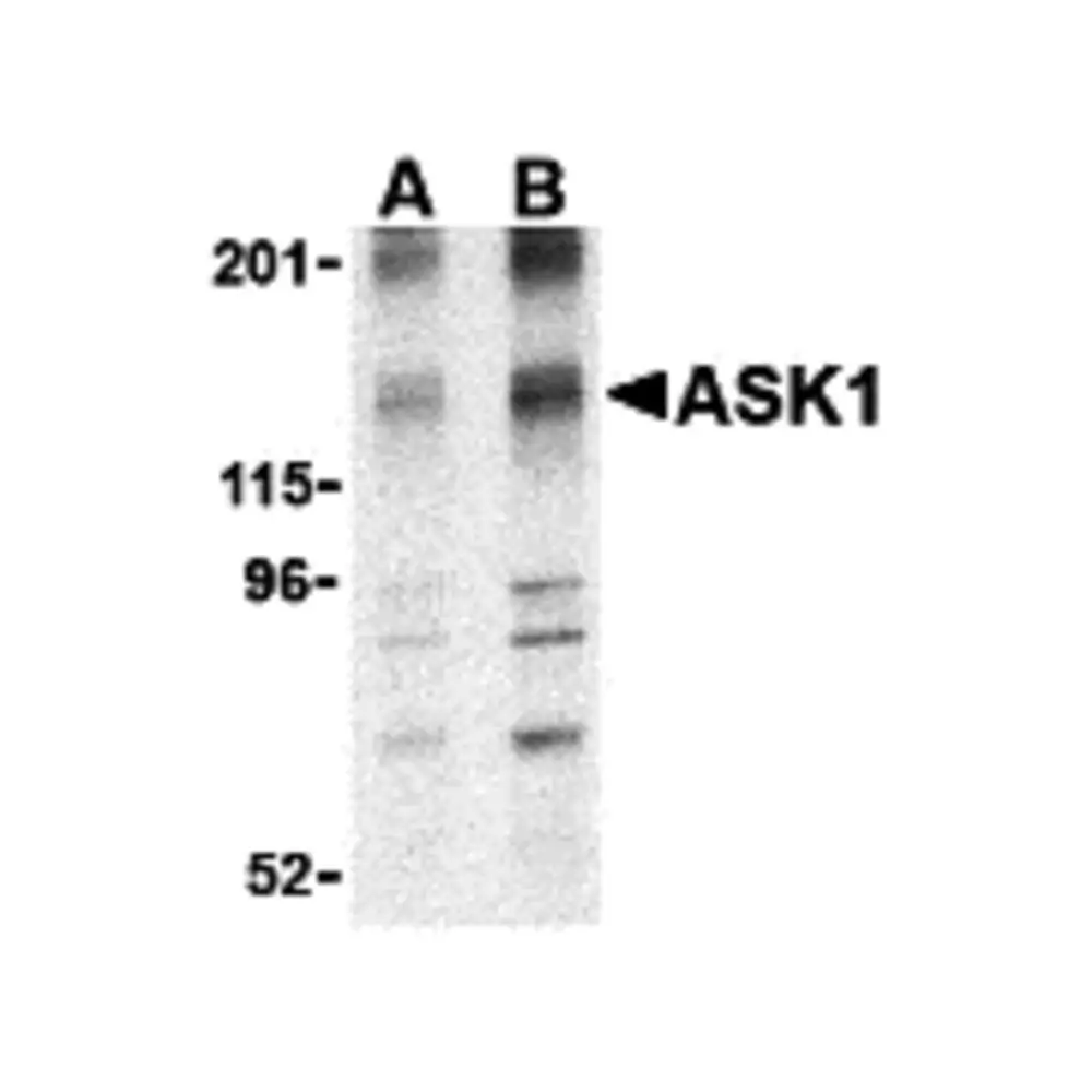 ProSci 3679 ASK1 Antibody, ProSci, 0.1 mg/Unit Primary Image