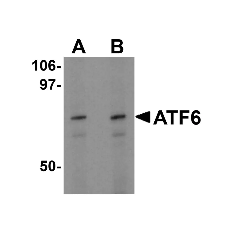 ProSci 3681_S ATF6 Antibody, ProSci, 0.02 mg/Unit Primary Image