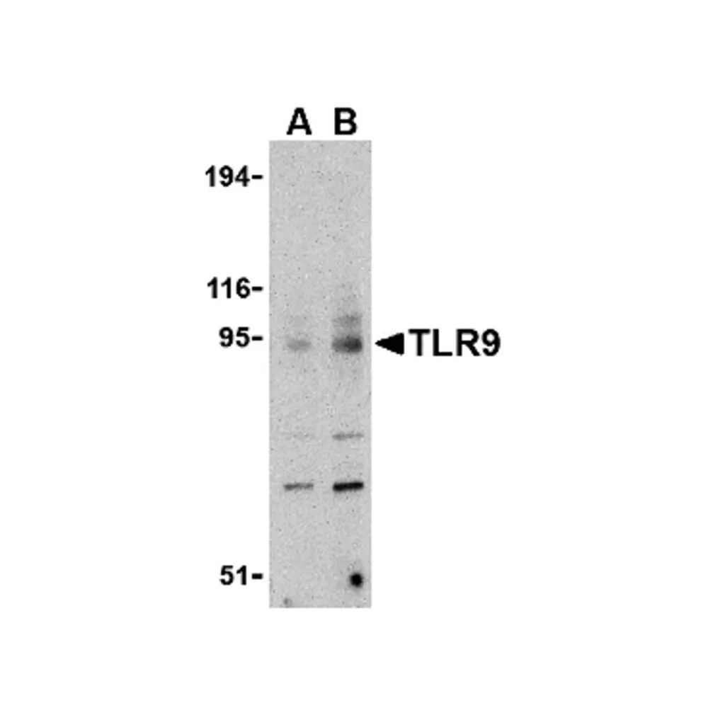 ProSci 3737 TLR9 Antibody, ProSci, 0.1 mg/Unit Primary Image