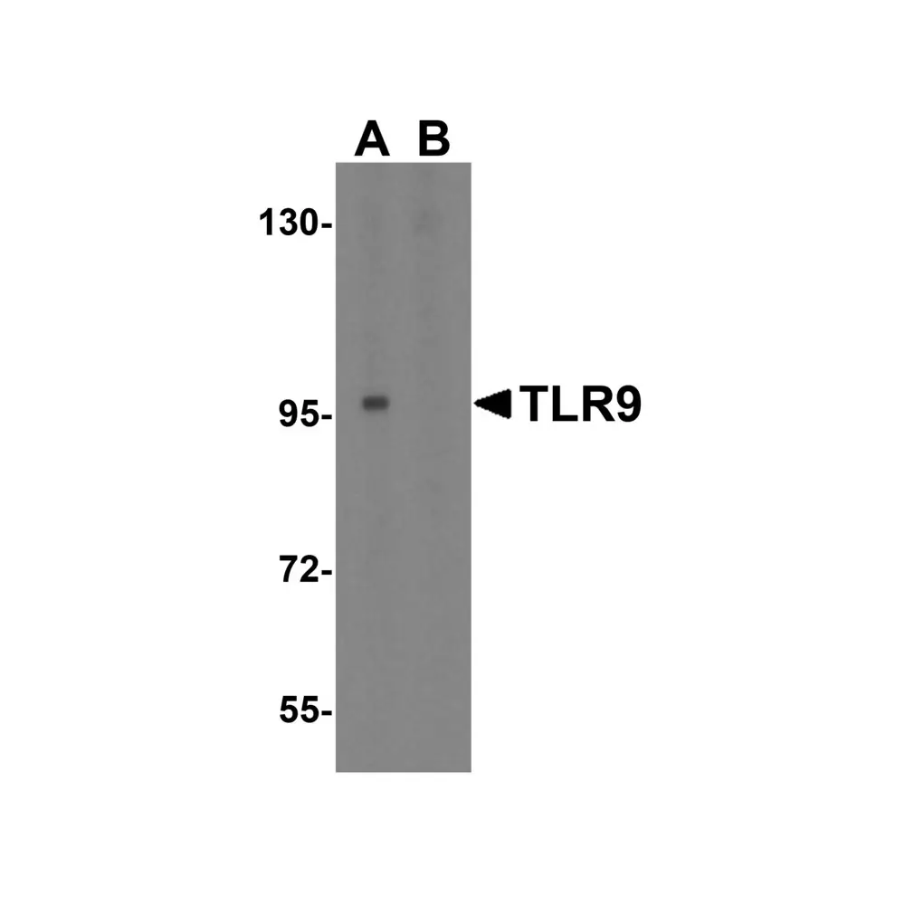 ProSci 3739_S TLR9 Antibody, ProSci, 0.02 mg/Unit Primary Image
