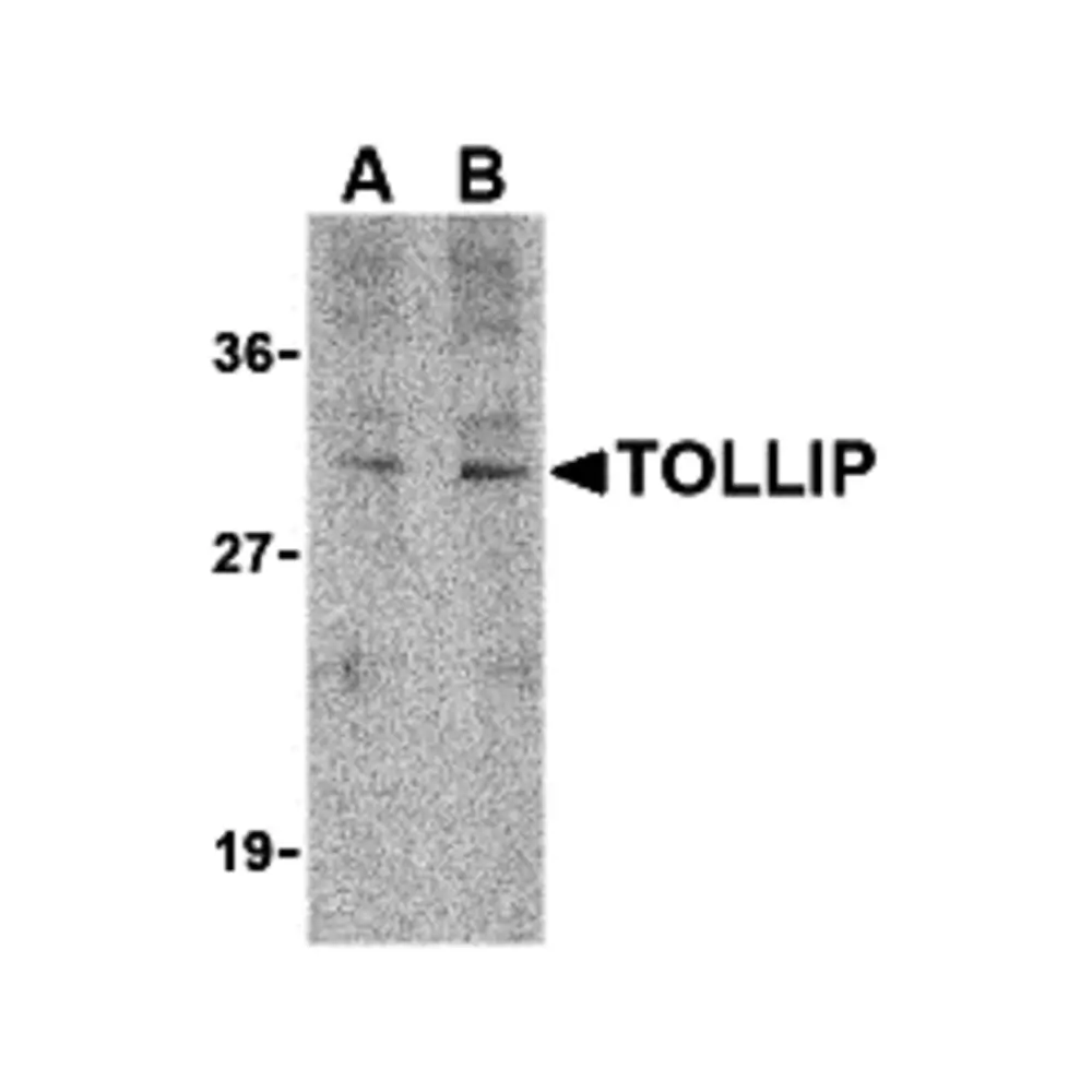 ProSci 3741 TOLLIP Antibody, ProSci, 0.1 mg/Unit Primary Image