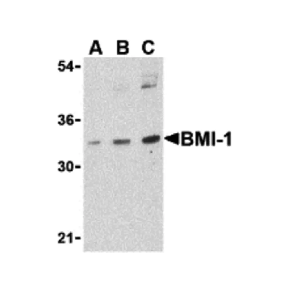 ProSci 3755_S BMI-1 Antibody, ProSci, 0.02 mg/Unit Primary Image