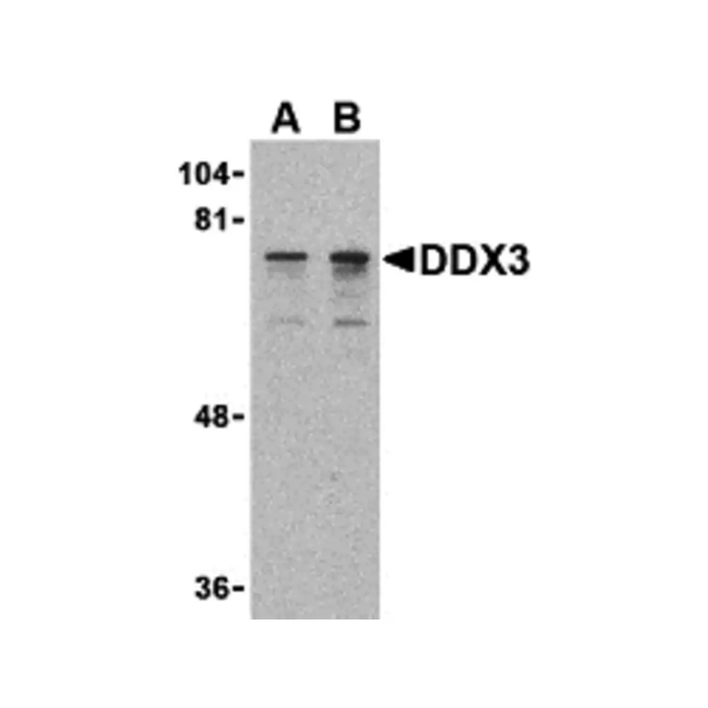 ProSci 3757 DDX3 Antibody, ProSci, 0.1 mg/Unit Primary Image