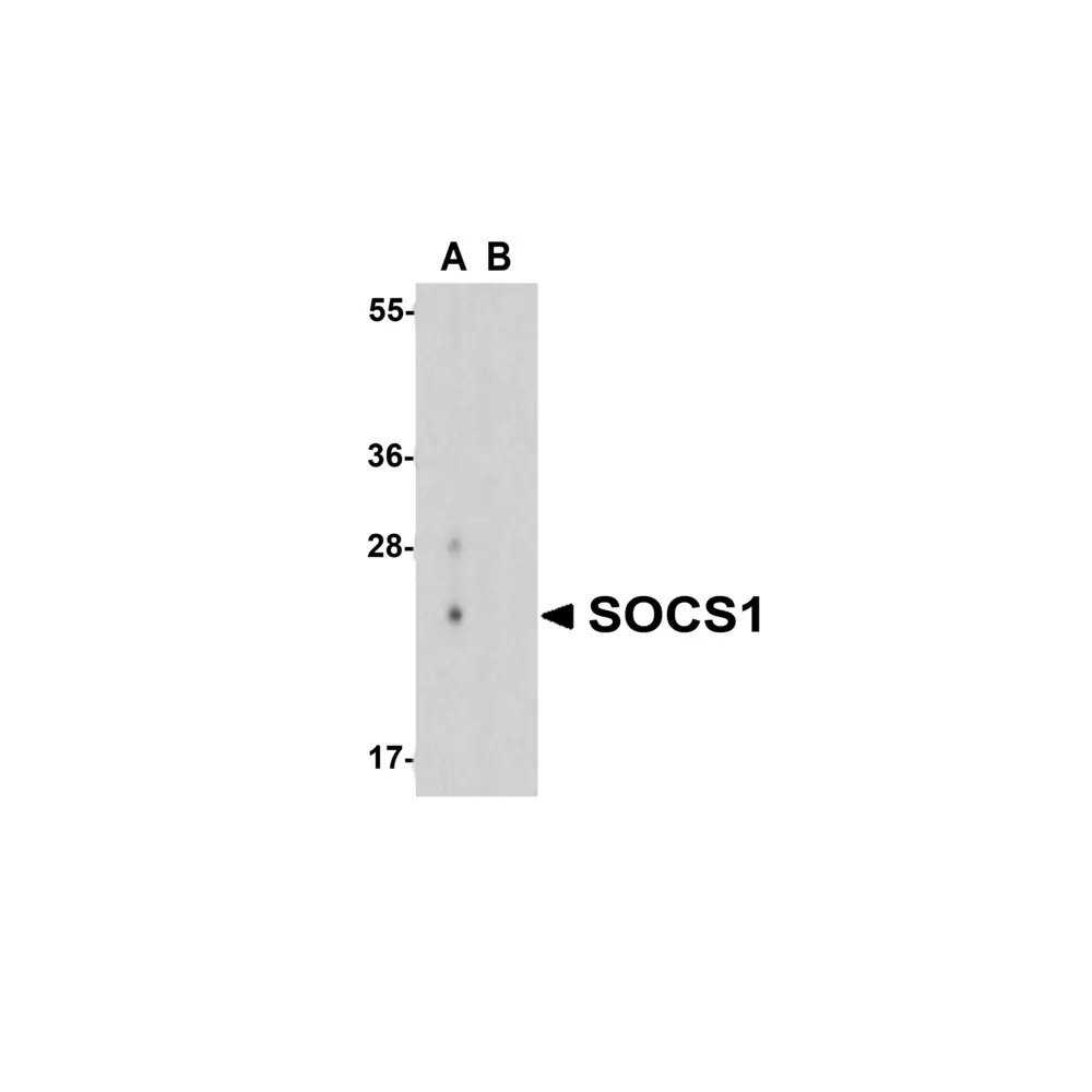 ProSci 3765 SOCS1 Antibody, ProSci, 0.1 mg/Unit Primary Image