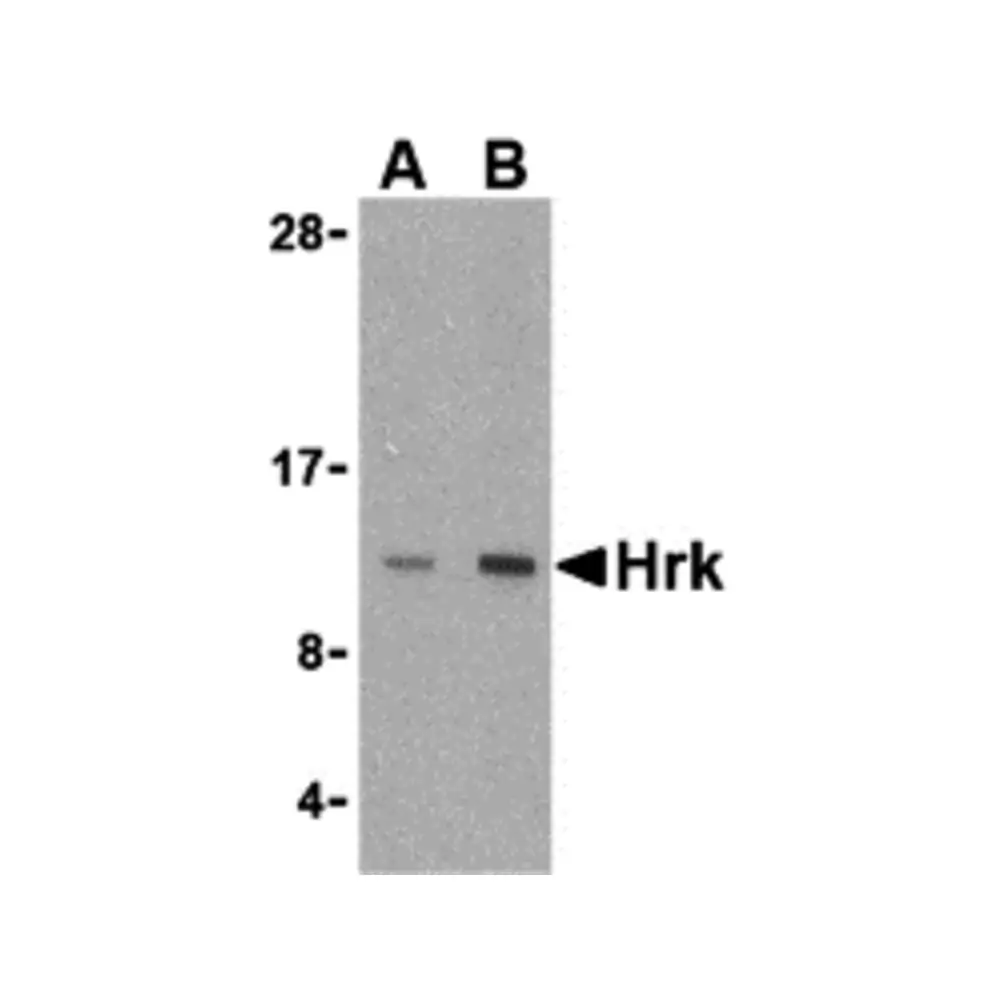 ProSci 3771_S Hrk Antibody, ProSci, 0.02 mg/Unit Primary Image
