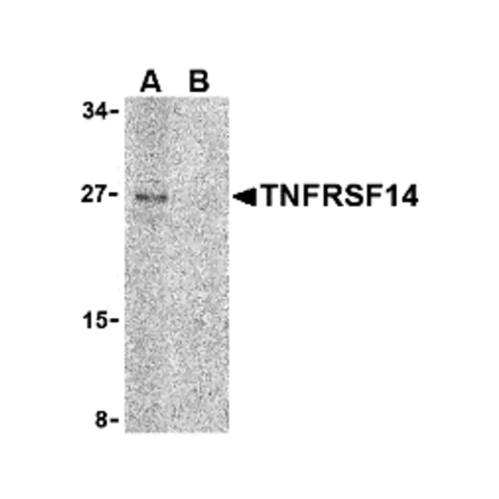 ProSci 3773 TNFRSF14 Antibody, ProSci, 0.1 mg/Unit Primary Image