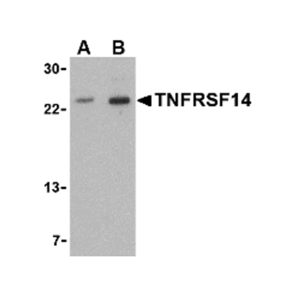 ProSci 3775 TNFRSF14 Antibody, ProSci, 0.1 mg/Unit Primary Image