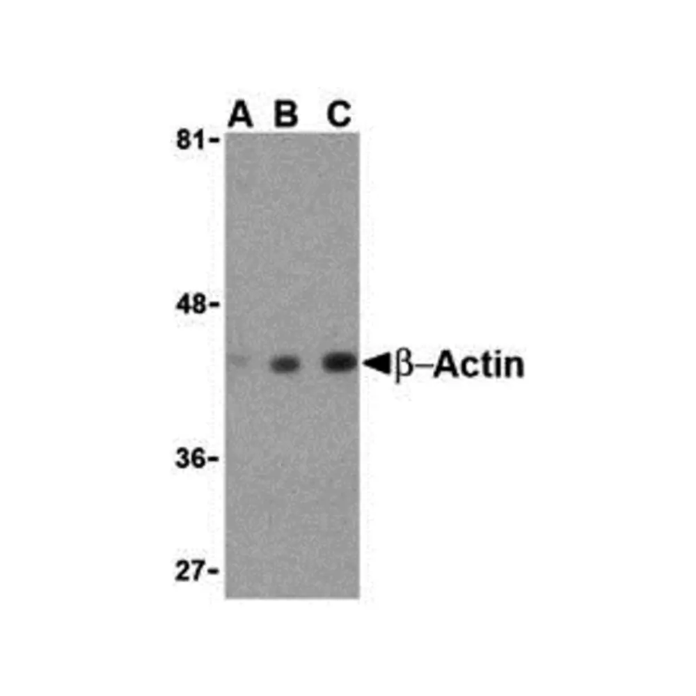 ProSci 3777_S Beta-actin Antibody, ProSci, 0.02 mg/Unit Primary Image