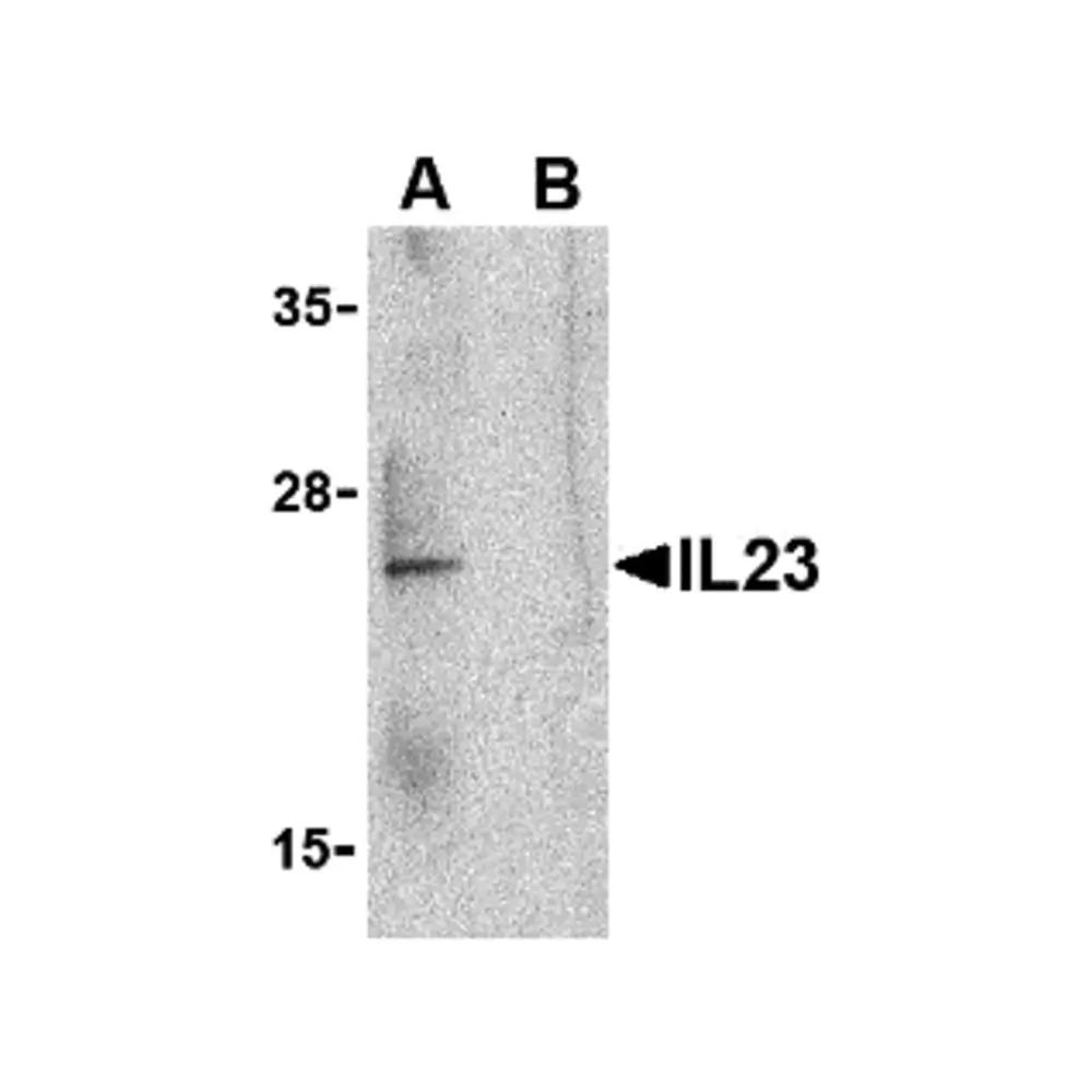 ProSci 3793 IL-23 Antibody, ProSci, 0.1 mg/Unit Primary Image