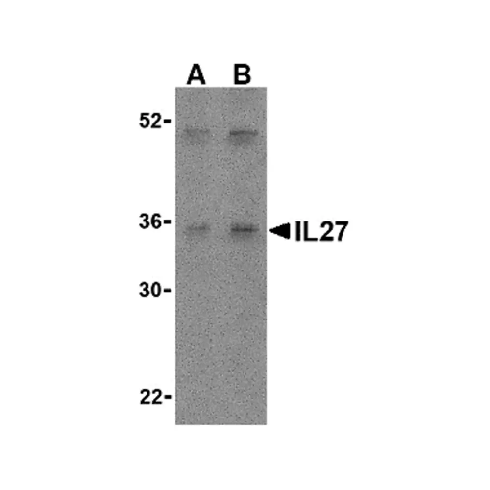 ProSci 3799_S IL-27 Antibody, ProSci, 0.02 mg/Unit Primary Image
