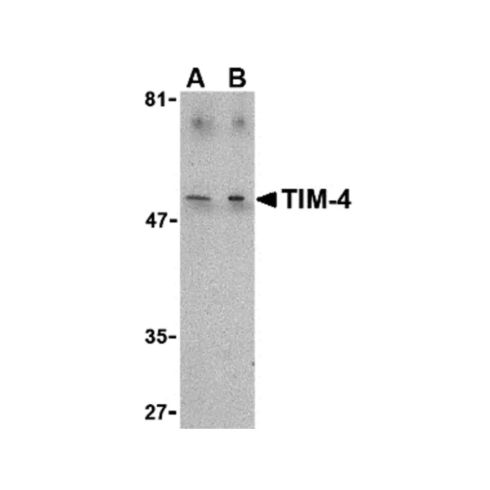 ProSci 3813 TIM-4 Antibody, ProSci, 0.1 mg/Unit Primary Image