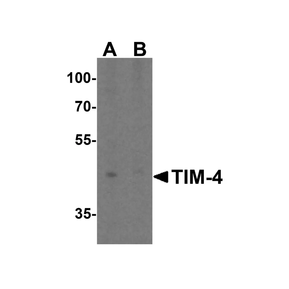 ProSci 3815_S TIM-4 Antibody, ProSci, 0.02 mg/Unit Primary Image
