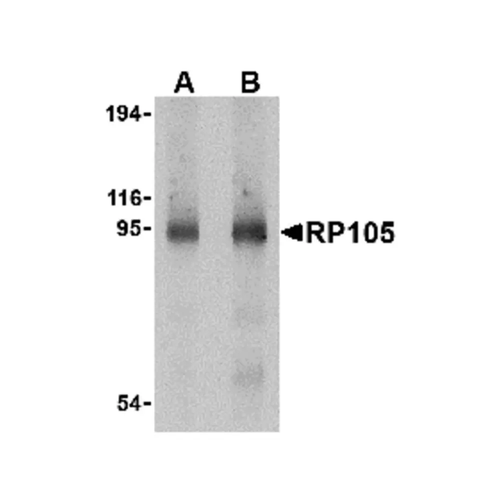 ProSci 3841 RP105 Antibody, ProSci, 0.1 mg/Unit Primary Image
