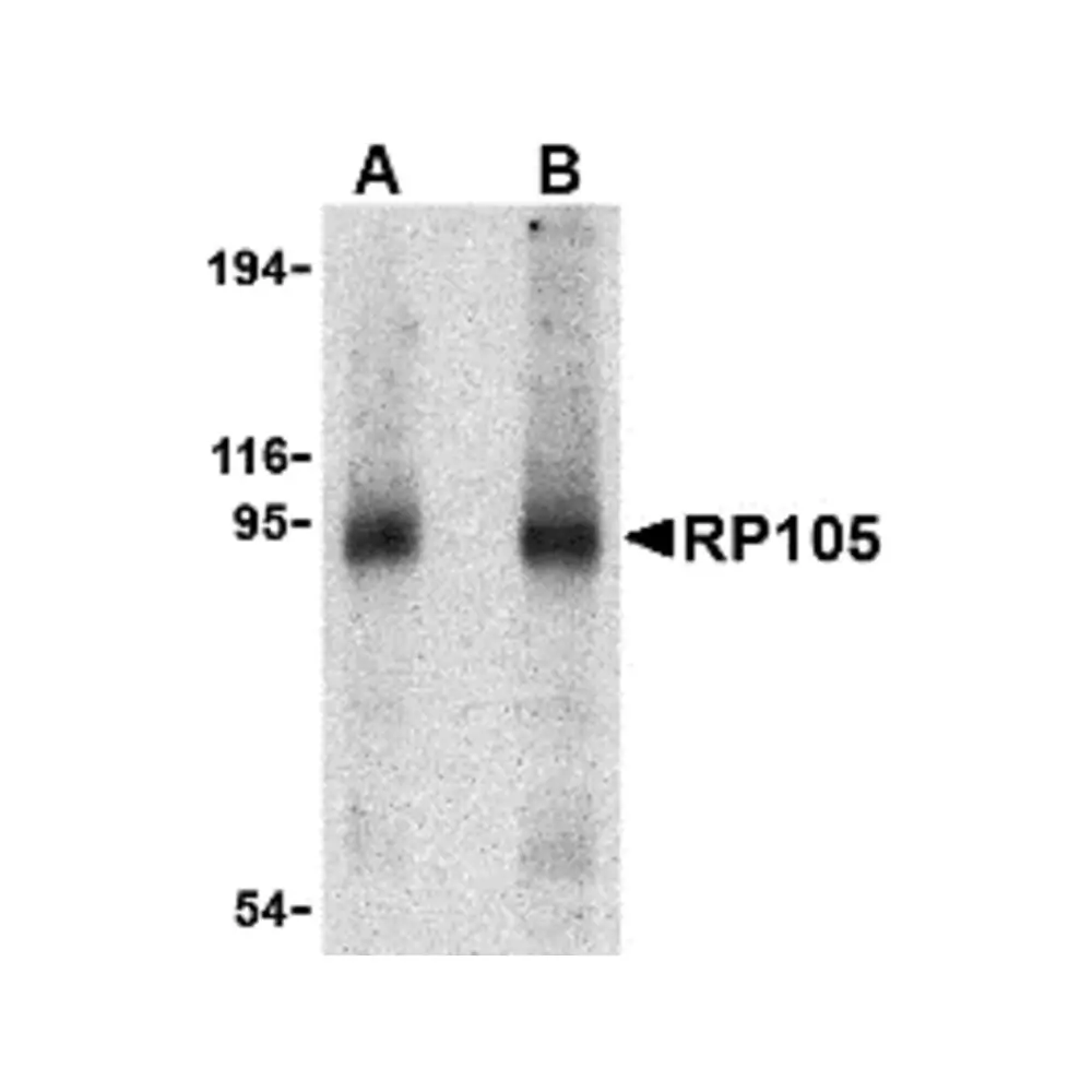 ProSci 3845 RP105 Antibody, ProSci, 0.1 mg/Unit Primary Image