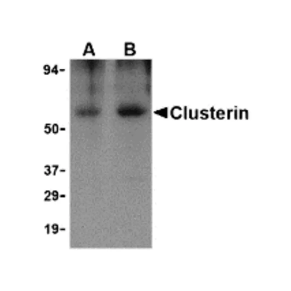 ProSci 3856_S Clusterin Antibody, ProSci, 0.02 mg/Unit Primary Image
