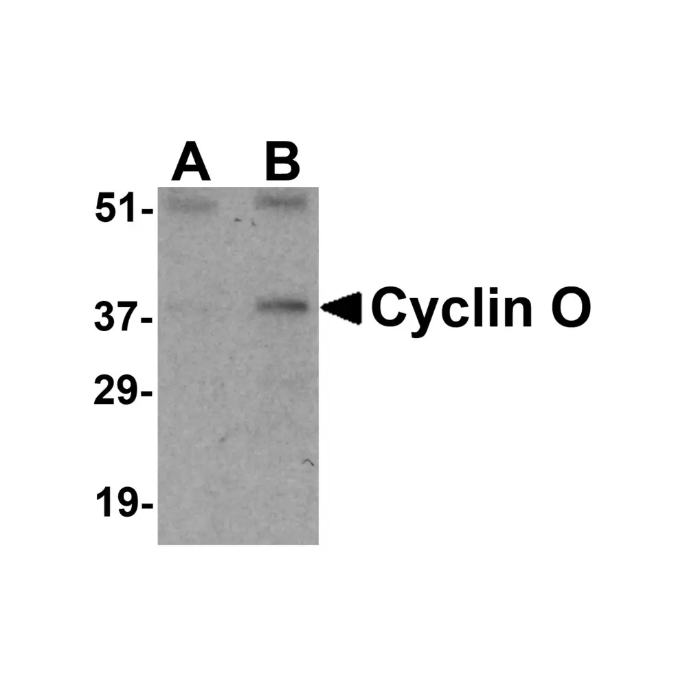 ProSci 3859 Cyclin O Antibody, ProSci, 0.1 mg/Unit Primary Image
