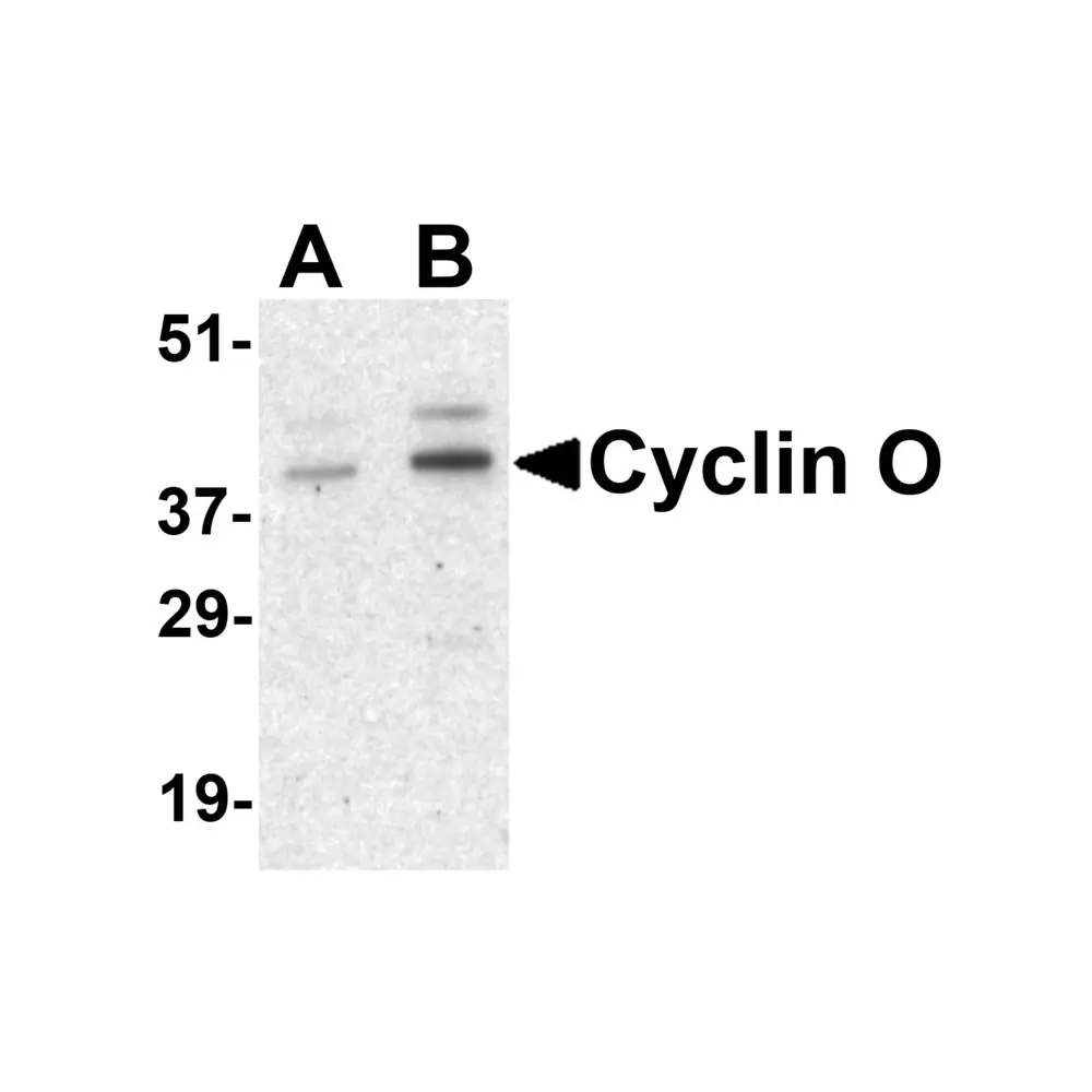 ProSci 3861_S Cyclin O Antibody, ProSci, 0.02 mg/Unit Primary Image